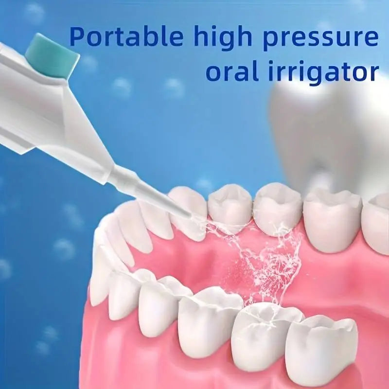 High - Pressure Portable Oral Irrigator - Deep Cleaning Water Jet for The Teeth and Gums.
